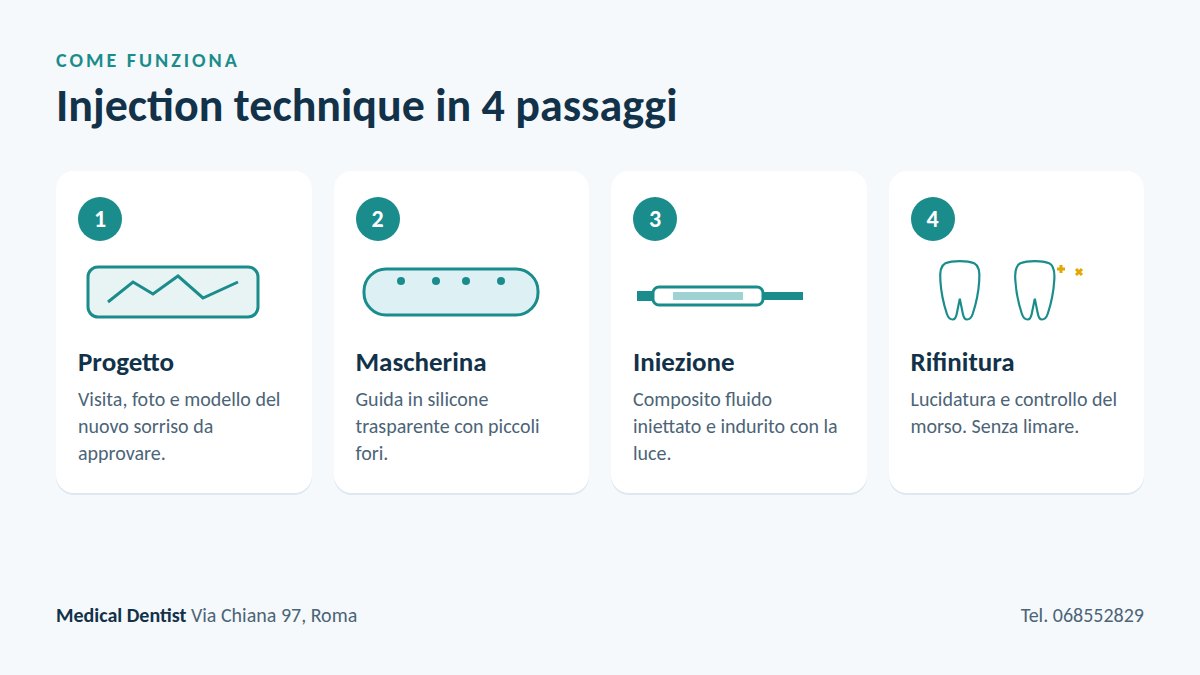 Injection technique in 4 passaggi: progetto, mascherina trasparente, iniezione del composito e rifinitura